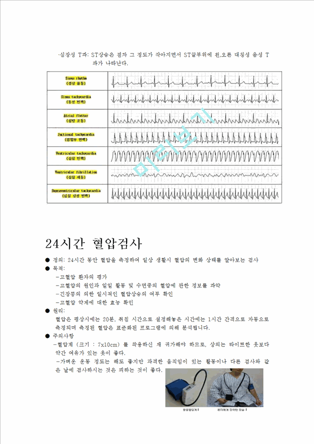 [의학,약학][의학] 심전도[ECG, EKG]에 관해서   (6 )